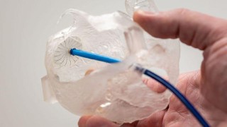 Pardubičtí kardiologové provedli v Česku unikátní zákrok za pomoci nového katetru a 3D modelu srdce